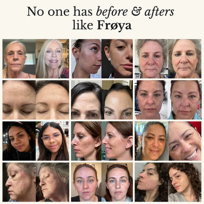 El Sistema Completo para la Piel de las Mujeres Boreal™️